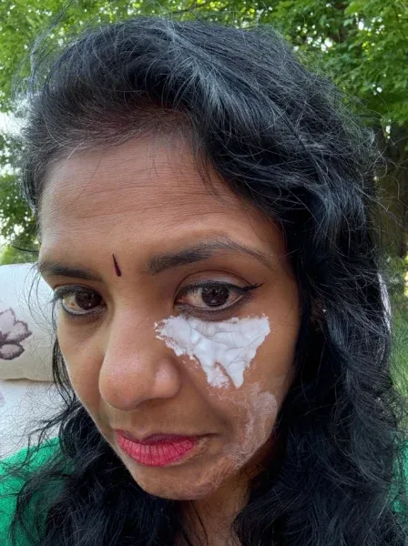 aruna r after applying baking soda and water paste 1 1